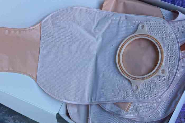 Colostomy bag change