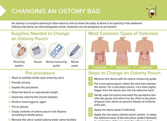 Colostomy urostomy ileostomy ostomy drainable care